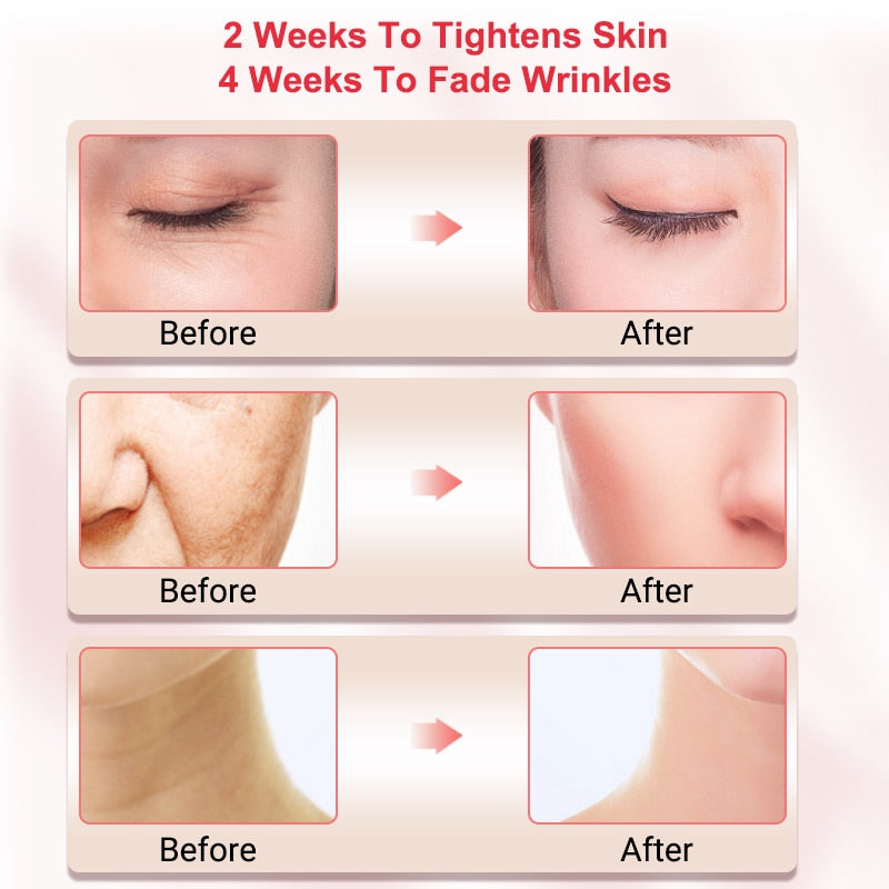 Radio Frequency beauty RF lifting EMS machine